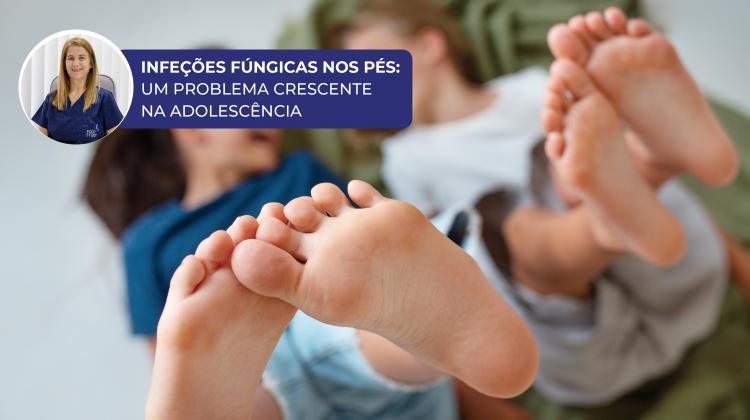 Fungal Infections in the Feet: Prevalence, Diagnosis, and Therapeutic Approach